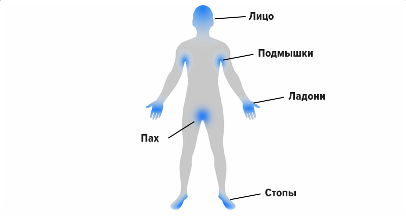 локализация потовых желез
